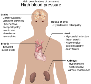 Natural High Blood Pressure Remedies for a Healthier Life